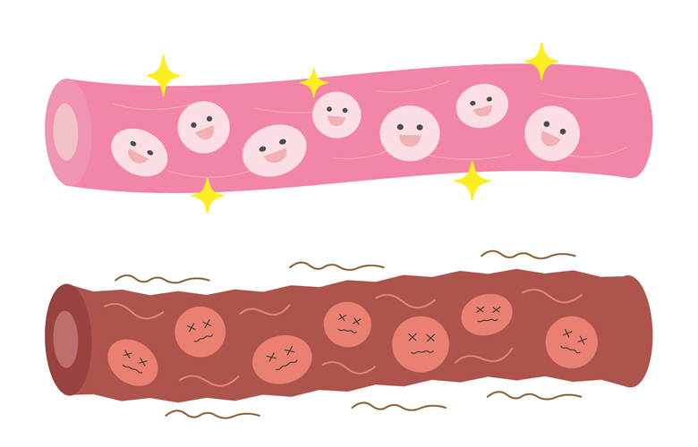 悪玉コレステロールを撃退！？動脈硬化を予防するためにしたいこと 